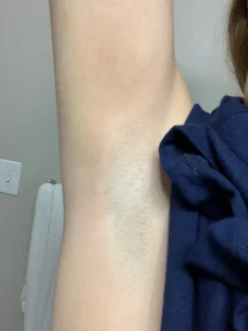 Lanveza™ IPL Laser Hair Removal Handset photo review