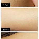 Lanveza™ IPL Laser Hair Removal Handset