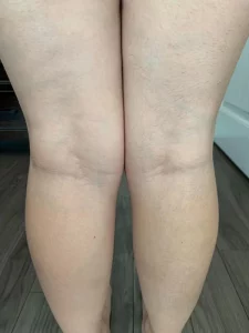 Lanveza™ IPL Laser Hair Removal Handset photo review