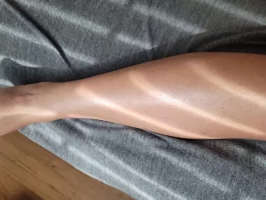 Lanveza™ IPL Laser Hair Removal Handset photo review