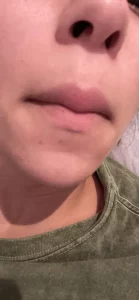 Lanveza™ IPL Laser Hair Removal Handset photo review