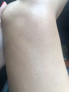 Lanveza™ IPL Laser Hair Removal Handset photo review