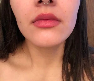 Lanveza™ IPL Laser Hair Removal Handset photo review