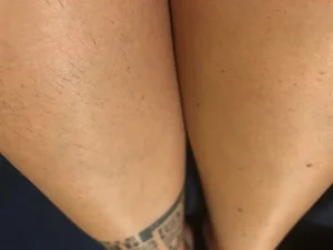 Lanveza™ IPL Laser Hair Removal Handset photo review