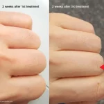 Lanveza™ IPL Laser Hair Removal Handset