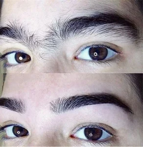 Lanveza™ IPL Laser Hair Removal Handset photo review